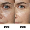 egf skin care